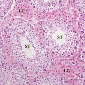 The seminiferous epithelial cycle and microanatomy of the Koala (Phascolarctos cinereus) and Southern Hairy-Nosed Wombat (Lasiorhinus latifrons) testis